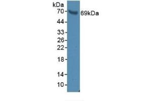 Detection of BFP in Rat Serum using Polyclonal Antibody to Brain Finger Protein (BFP) (RNF112 Antikörper  (AA 256-504))