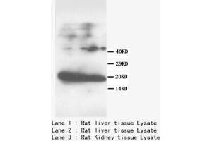 Image no. 2 for anti-Fatty Acid Binding Protein 1, Liver (FABP1) (N-Term) antibody (ABIN1495134) (FABP1 Antikörper  (N-Term))
