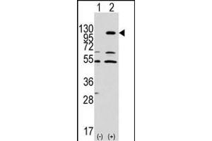 Western blot analysis of EphA7 (arrow) using rabbit polyclonal EphA7 Antibody (ABIN391900 and ABIN2841718). (EPH Receptor A7 Antikörper)