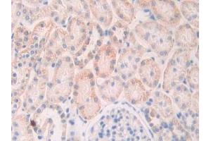 Immunohistochemistry (IHC) image for anti-Slit Homolog 1 (SLIT1) (AA 308-512) antibody (ABIN7438097)