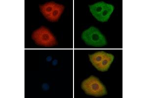 ABIN6264912 and ABIN6269293 staining Hela cells by IF/ICC. (RPS6 Antikörper  (C-Term))