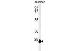Western Blotting (WB) image for anti-THO Complex 7 (THOC7) antibody (ABIN3004372) (THOC7 Antikörper)