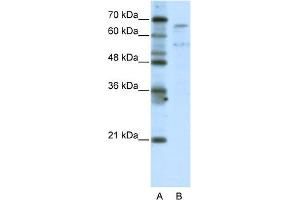 WB Suggested Anti-TAF6L Antibody Titration:  5. (TAF6L Antikörper  (N-Term))