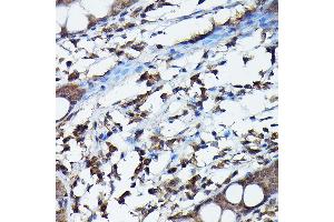 Immunohistochemistry (IHC) image for anti-Apolipoprotein B mRNA Editing Enzyme, Catalytic Polypeptide-Like 3G (APOBEC3G) (AA 60-330) antibody (ABIN6137010)