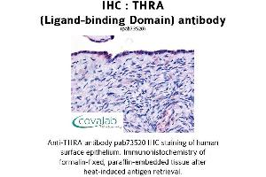 Image no. 1 for anti-Thyroid Hormone Receptor, alpha (THRA) antibody (ABIN1740044) (THRA Antikörper)