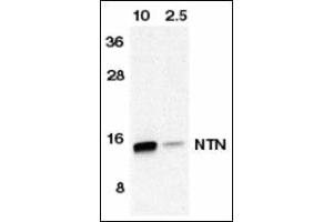 Western blot analysis of NTN in HeLa cell lyaste containing 10 or 2. (Neurturin Antikörper  (AA 178-193))