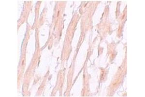 Immunohistochemistry (Paraffin-embedded Sections) (IHC (p)) image for anti-ATG9 Autophagy Related 9 Homolog A (S. Cerevisiae) (ATG9A) (C-Term) antibody (ABIN783751)