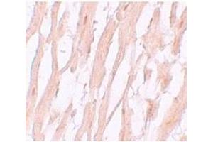Immunohistochemistry of ATG9A in human heart tissue with ATG9A antibody at 5 μg/mL. (ATG9A Antikörper  (C-Term))