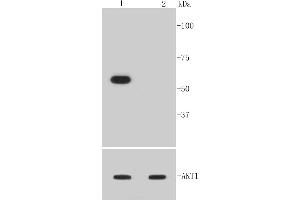 Lane 1: NIH/3T3 treated with PDGF, Lane 2: NIH/3T3 untreatedlysates probed with Akt1(Ser473) (12A1) Monoclonal Antibody  at 1:1000 overnight at 4˚C. (AKT1 Antikörper  (pSer473))