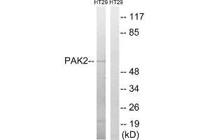 Western Blotting (WB) image for anti-P21-Activated Kinase 2 (PAK2) (Ser62) antibody (ABIN1848252) (PAK2 Antikörper  (Ser62))
