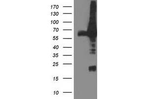 Western Blotting (WB) image for anti-Dipeptidyl-Peptidase 3 (DPP3) antibody (ABIN1497831) (DPP3 Antikörper)