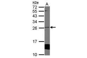 Image no. 1 for anti-Cytoglobin (CYGB) (AA 1-190) antibody (ABIN1501883) (CYGB Antikörper  (AA 1-190))
