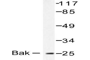 Image no. 1 for anti-BCL2-Antagonist/killer 1 (BAK1) antibody (ABIN265324) (BAK1 Antikörper)