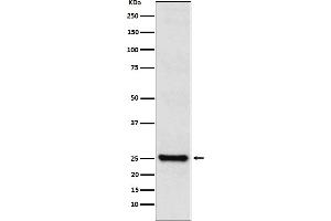 Western blot analysis of TPPP expression in SHSY5Y cell lysate.