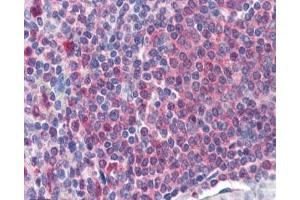 IHC staining of FFPE human spleen with Catalase antibody at 2ug/ml. (Catalase Antikörper)