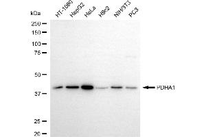 anti-Pyruvate Dehydrogenase (Lipoamide) alpha 1 (PDHA1) antibody