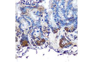 Immunohistochemistry of paraffin-embedded mouse intestin using ITLN1 Rabbit pAb (ABIN6132446, ABIN6142601, ABIN6142602 and ABIN6223070) at dilution of 1:100 (40x lens). (ITLN1/Omentin Antikörper  (AA 19-313))