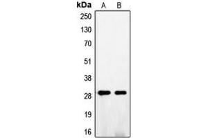 Western blot analysis of FGF5 expression in A375 (A), NIH3T3 (B) whole cell lysates. (FGF5 Antikörper  (C-Term))