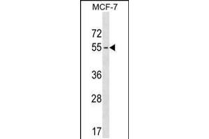 Western blot analysis in MCF-7 cell line lysates (35ug/lane). (MAGEB18 Antikörper  (AA 214-242))