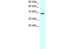 WB Suggested Anti-CCRN4L Antibody Titration:  1. (CCRN4L Antikörper  (N-Term))