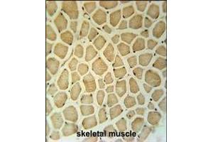 RPS3A Antibody (C-term) (ABIN651720 and ABIN2840374) immunohistochemistry analysis in formalin fixed and paraffin embedded human skeletal muscle followed by peroxidase conjugation of the secondary antibody and DAB staining. (RPS3A Antikörper  (C-Term))