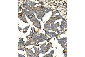 IHC analysis of BubR1/BUB1B using anti-BubR1/BUB1B antibody (ABIN7600960). (BUB1B Antikörper  (AA 26-448))