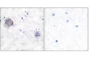 Immunohistochemical analysis of paraffin-embedded human brain tissue, using Notch 1 (cleaved-Val1744) antibody. (Notch1 Antikörper  (Cleaved-Val1754, Internal Region))