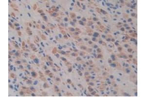 IHC-P analysis of Mouse Liver Tissue, with DAB staining. (SLIT1 Antikörper  (AA 603-773))