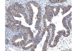 IHC analysis of Poliovirus Receptor/PVR using anti-Poliovirus Receptor/PVR antibody (ABIN7601071). (Poliovirus Receptor Antikörper  (AA 28-331))