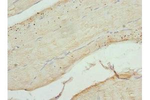 Immunohistochemistry of paraffin-embedded human skeletal muscle tissue using ABIN7148048 at dilution of 1:100 (Cofilin 2 Antikörper  (AA 1-166))