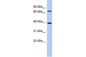 WB Suggested Anti-NYD-SP21 Antibody Titration:  0. (MS4A14 Antikörper  (Middle Region))