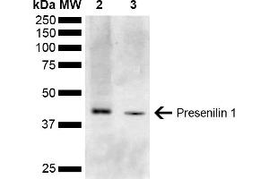 Western blot analysis of Mouse Kidney, Liver showing detection of ~52. (Presenilin 1 Antikörper  (AA 1-100) (HRP))
