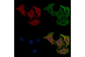 ABIN6256886 and ABIN6274785 staining Hela cells by IF/ICC.