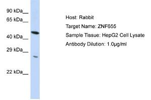 Host:  Rabbit  Target Name:  ZNF655  Sample Type:  HepG2 Whole Cell lysates  Antibody Dilution:  1. (ZNF655 Antikörper  (N-Term))