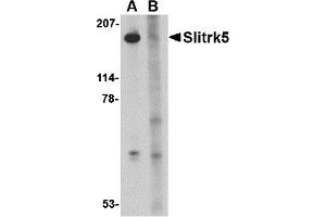 Western Blotting (WB) image for anti-SLIT and NTRK-Like Family, Member 5 (SLITRK5) (Middle Region 2) antibody (ABIN1031202)