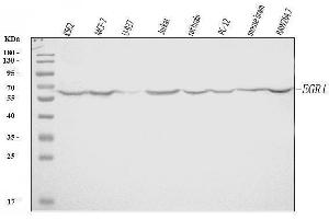 Western blot analysis of EGR1 using anti-EGR1 antibody (ABIN7600495).