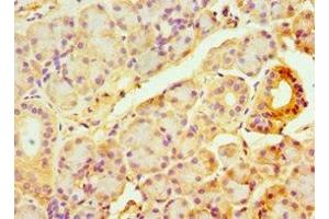 Immunohistochemistry of paraffin-embedded human pancreatic tissue using ABIN7144328 at dilution of 1:100 (TAP1 Antikörper  (AA 524-808))