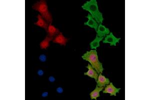 DHX32 Antibody staining HepG2 cells by IF/ICC. (DHX32 Antikörper)