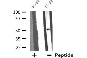 Western blot analysis of extracts from HT-29 cells, using DDX19B antibody. (DDX19B Antikörper  (N-Term))