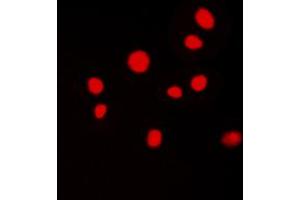 Immunofluorescent analysis of ATRIP staining in MCF7 cells. (ATRIP Antikörper  (N-Term))