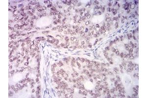 Immunohistochemistry (IHC) image for anti-Lysine (K)-Specific Demethylase 1A (KDM1A) (AA 709-876) antibody (ABIN7193459)