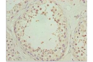Immunohistochemistry of paraffin-embedded human testis tissue using ABIN7176149 at dilution of 1:100