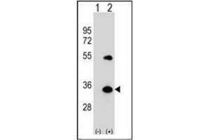 Western Blotting (WB) image for anti-ATG5 Autophagy Related 5 (ATG5) (AA 1-30), (N-Term) antibody (ABIN1449605)