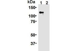Western Blotting (WB) image for anti-Kinesin Family Member 11 (KIF11) (AA 1-1056), (N-Term) antibody (ABIN1449288) (KIF11 Antikörper  (N-Term))