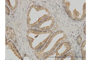 Immunoperoxidase of monoclonal antibody to TUBA1B on formalin-fixed paraffin-embedded human prostate. (TUBA1B Antikörper  (AA 1-451))