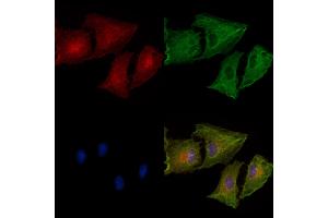 Phospho-IP3 Receptor (Ser1764) Antibody staining A549 cells(heat shock treatment) by IF/ICC. (IP3 Receptor Antikörper  (pSer1764))