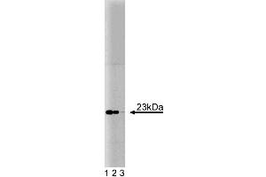 Western blot analysis of Bad on an A431 cell lysate (Human epithelial carcinoma, ATCC CRL-1555).