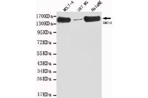 Western blot detection of SMC1A(C-term) in MOLT-4,U87 MG and HelaNE cell lysates using SMC1A (N-terminus) mouse mAb (1:1000 diluted). (SMC1A Antikörper  (C-Term))