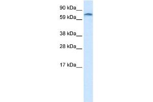 WB Suggested Anti-ZNF84 Antibody Titration:  1. (ZNF84 Antikörper  (C-Term))