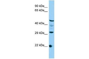 Host: Rabbit Target Name: C3orf26 Sample Type: HepG2 Whole Cell lysates Antibody Dilution: 1.